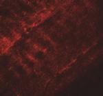 SYNPO2 Antibody in Immunohistochemistry (IHC)