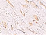 PEAR1 Polyclonal Antibody