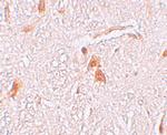 SHISA9 Polyclonal Antibody