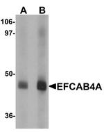 EFCAB4A Polyclonal Antibody