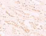 EFCAB4B Polyclonal Antibody