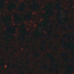 LMBRD1 Antibody in Immunohistochemistry (IHC)