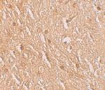 LMBRD1 Polyclonal Antibody