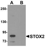 STOX2 Antibody in Western Blot (WB)