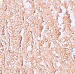 ZIP10 Polyclonal Antibody