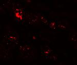 ZIP1 Antibody in Immunohistochemistry (IHC)