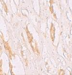 ZIP1 Polyclonal Antibody