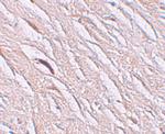 SLC39A2 Polyclonal Antibody