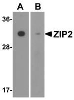 SLC39A2 Antibody in Western Blot (WB)