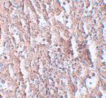 SLC39A5 Polyclonal Antibody