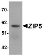 SLC39A5 Antibody in Western Blot (WB)