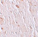 SLC39A7 Polyclonal Antibody