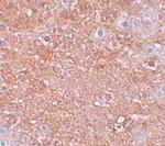 ZIP12 Polyclonal Antibody