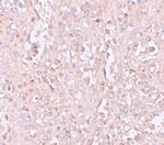 ZIP13 Polyclonal Antibody