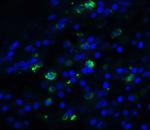 TFF3 Antibody in Immunohistochemistry (IHC)