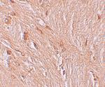 ZBTB3 Polyclonal Antibody