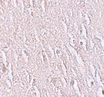 ZBTB5 Polyclonal Antibody