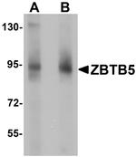 ZBTB5 Antibody in Western Blot (WB)