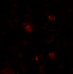 ZBTB6 Antibody in Immunocytochemistry (ICC/IF)
