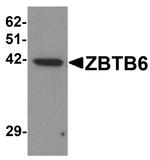 ZBTB6 Antibody in Western Blot (WB)