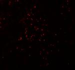 Pokemon Antibody in Immunohistochemistry (IHC)