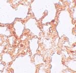 ZMYM1 Polyclonal Antibody
