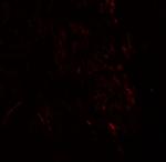 ZMYM3 Polyclonal Antibody