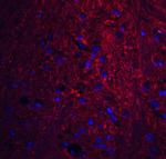 PION Antibody in Immunohistochemistry (IHC)