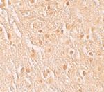 PION Antibody in Immunohistochemistry (IHC)