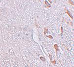 LRRTM1 Polyclonal Antibody