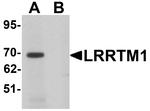 LRRTM1 Antibody in Western Blot (WB)