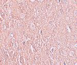LRRTM2 Polyclonal Antibody