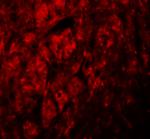 LRRTM3 Antibody in Immunohistochemistry (IHC)