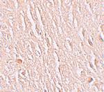 LRRTM3 Polyclonal Antibody