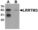 LRRTM3 Antibody in Western Blot (WB)