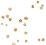 N4BP1 Polyclonal Antibody