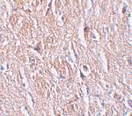 LRRTM4 Polyclonal Antibody