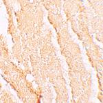 VPS39 Antibody in Immunohistochemistry (IHC)
