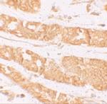 RHAMM Polyclonal Antibody
