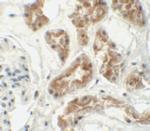 ZNF346 Polyclonal Antibody