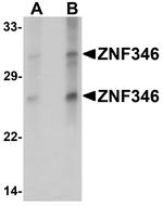 ZNF346 Antibody in Western Blot (WB)