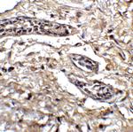 BCL9L Antibody in Immunohistochemistry (IHC)