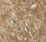 CTNNBL1 Polyclonal Antibody