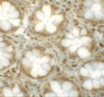 LRRFIP1 Polyclonal Antibody