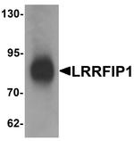 LRRFIP1 Antibody in Western Blot (WB)