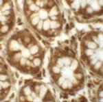 LRRFIP2 Polyclonal Antibody