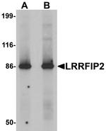 LRRFIP2 Antibody in Western Blot (WB)