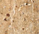 TMEM192 Polyclonal Antibody