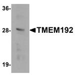 TMEM192 Antibody in Western Blot (WB)