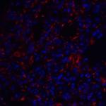 TM4SF1 Antibody in Immunohistochemistry (IHC)